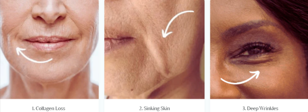 South Beach Collagen Filler Serum 3 step