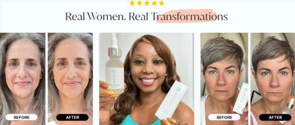 South Beach Collagen Filler Serum user
